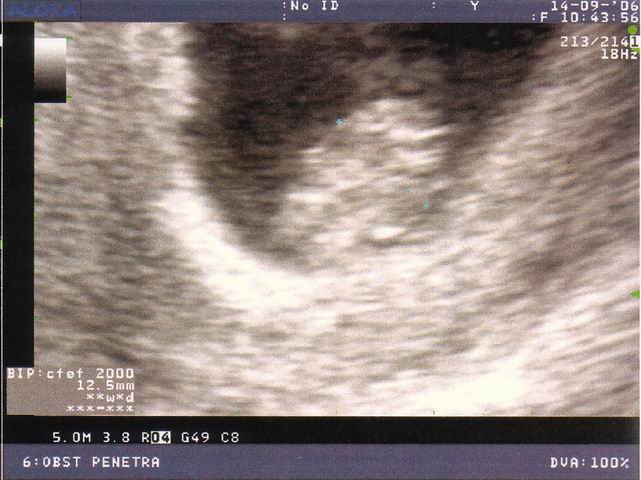 2006.09.14 echo2.jpg